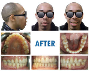 Future Smiles Orthodontics Guam